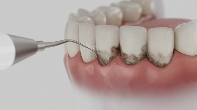 Reliable Emergency Dentist contractor in Lafayette, OR by Smile Center Dentistry
